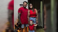 患罕见皮肤病动219次手术 巴西女圆梦诞下健康女儿